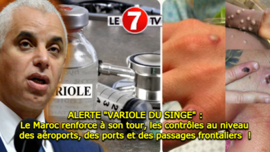Photo of Alerte : Le Maroc renforce à son tour, les contrôles contre « La variole du Singe » !