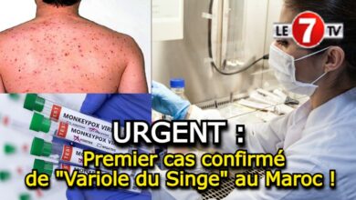 Photo of URGENT : Premier cas confirmé de « Variole du Singe » au Maroc !