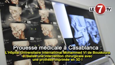 Photo of L’Hôpital Universitaire International Mohammed VI de Bouskoura réalise une intervention chirurgicale avec une prothèse imprimée en 3D !
