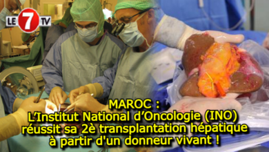 Photo of L’Institut National d’Oncologie (INO) réussit sa 2è transplantation hépatique à partir d’un donneur vivant