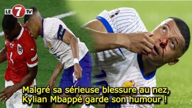 Photo of Malgré sa sérieuse blessure au nez, Kylian Mbappé garde son humour ! 