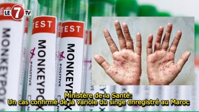 Photo of Ministère de la Santé: Un cas confirmé de la variole du singe enregistré au Maroc 